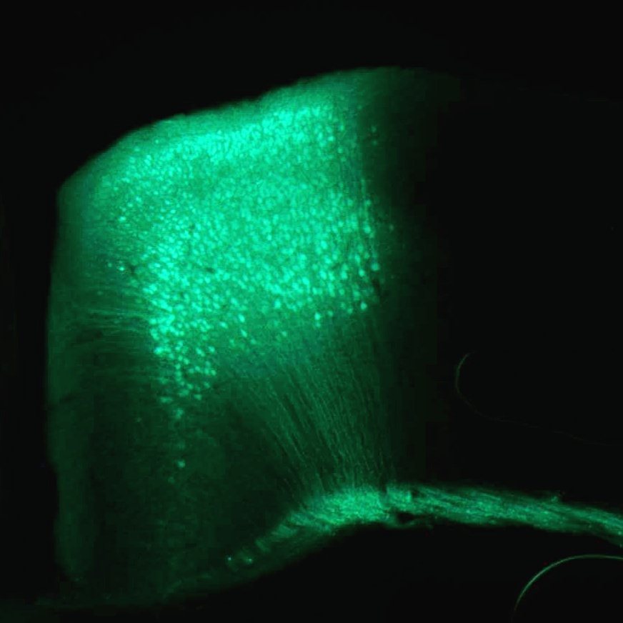 Densely labelled green fluorescent neurons and fibres on a black background.