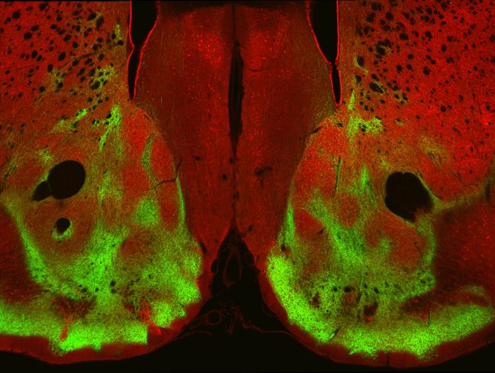 Coronal brain section showing bilateral green fluorescent labelling in the nucleus accumbens against a red fluorescent background.