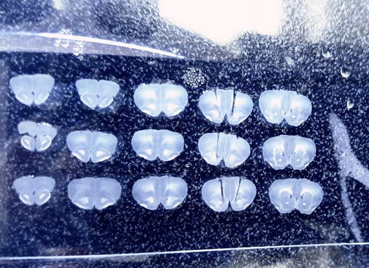 Rows of pale brain sections mounted on glass slides.