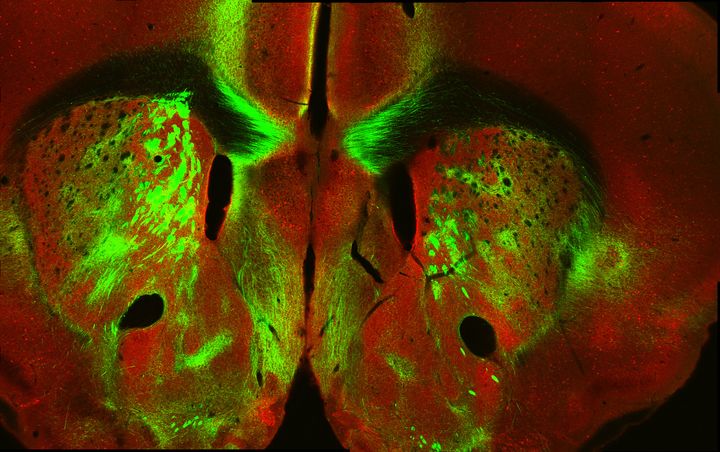 Coronal section through both hemispheres with red and green fluorescent labelling around the ventricles.