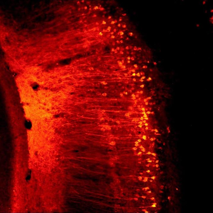 Red fluorescent cells arranged along a band of tissue.