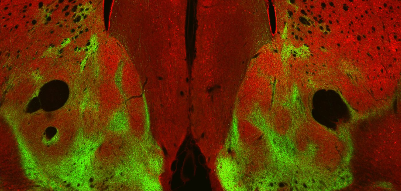 Coronal brain section showing bilateral green fluorescent labelling in the nucleus accumbens against a red fluorescent background.